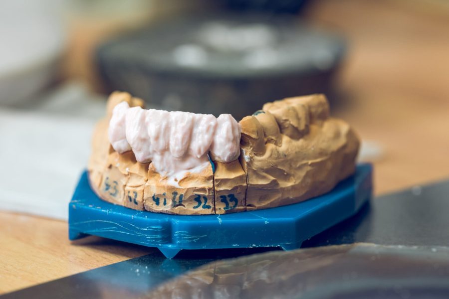 Çene Kisti Tedavisi MedipiaDent